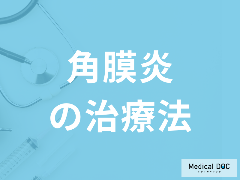 コンタクト使用者に多い「角膜炎の治療」に市販の目薬はおすすめしない?医師が解説!
