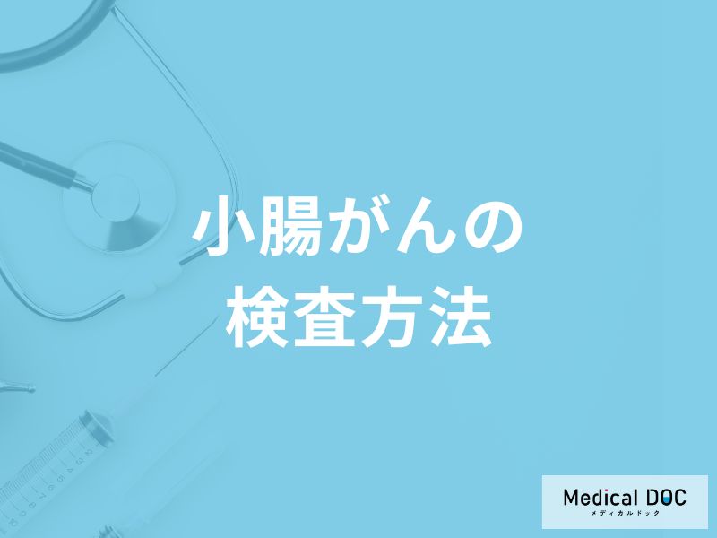 「小腸がんの検査方法」はご存知ですか?【医師監修】