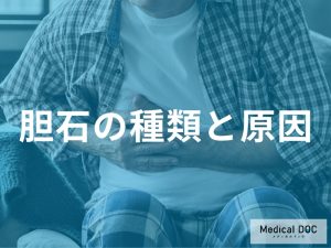 胆石の種類と原因の関係