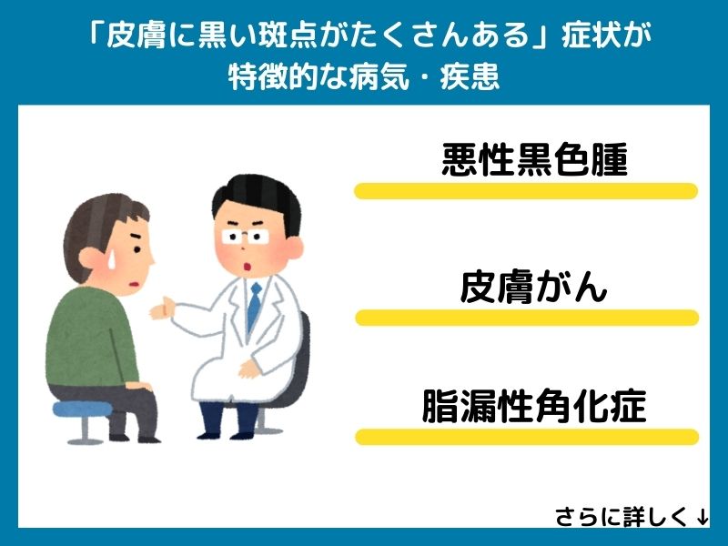「皮膚に黒い斑点がたくさんある」症状が特徴的な病気・疾患