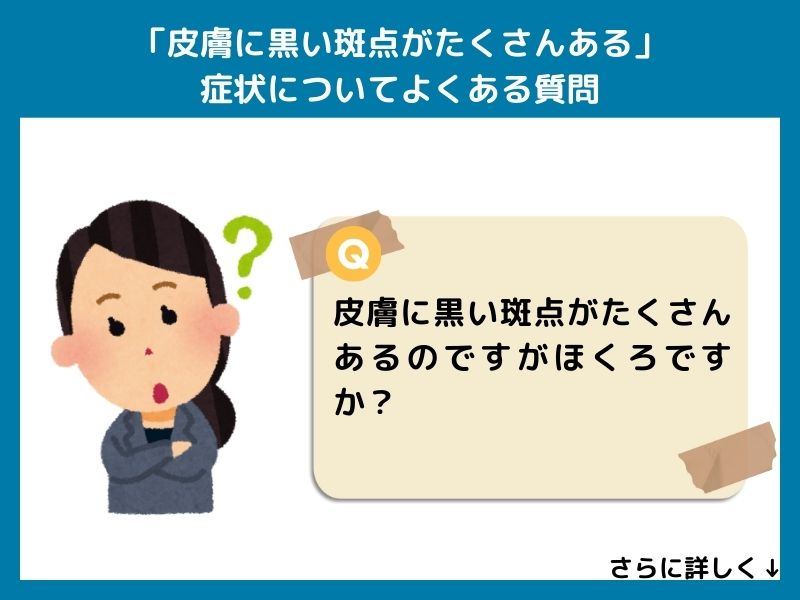 「皮膚に黒い斑点がたくさんある」症状についてよくある質問