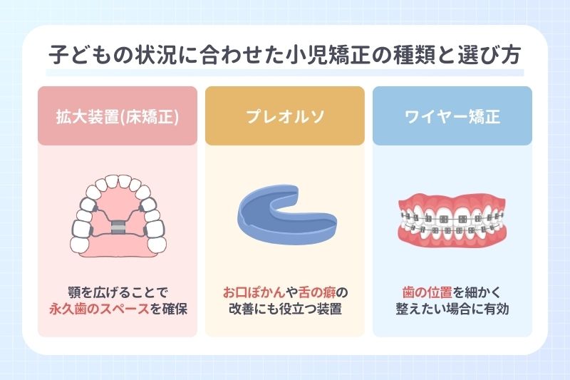 子どもの状況に合わせた小児矯正の種類と選び方