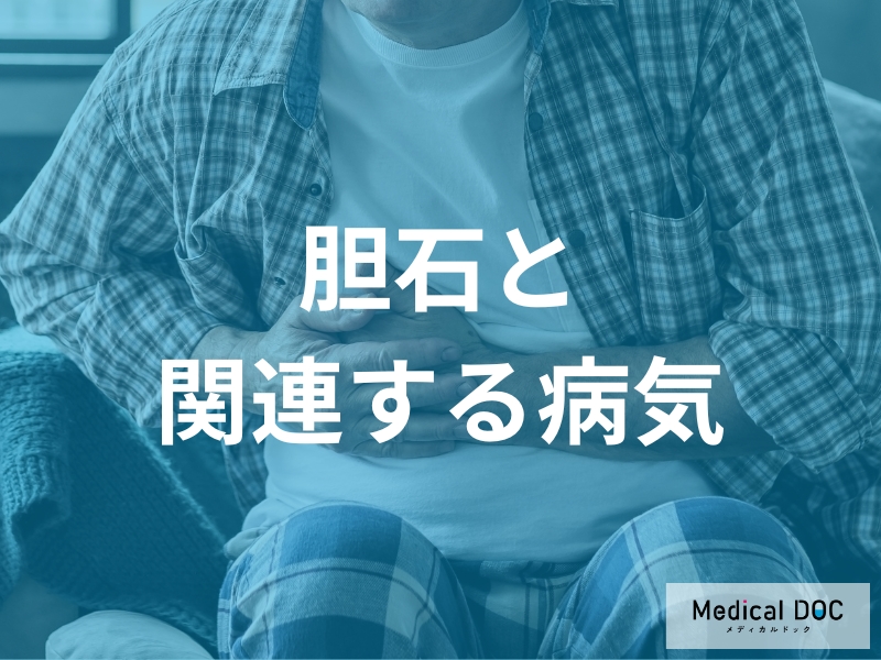 胆石と関連する病気