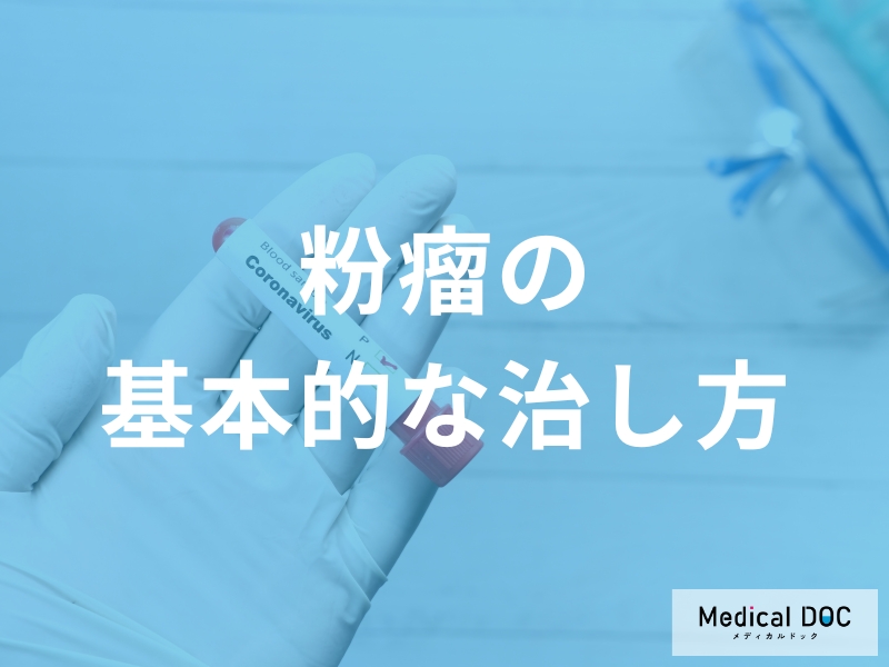 粉瘤を根本から治す：手術で「袋ごと取る」ことの重要性と治療の選択肢