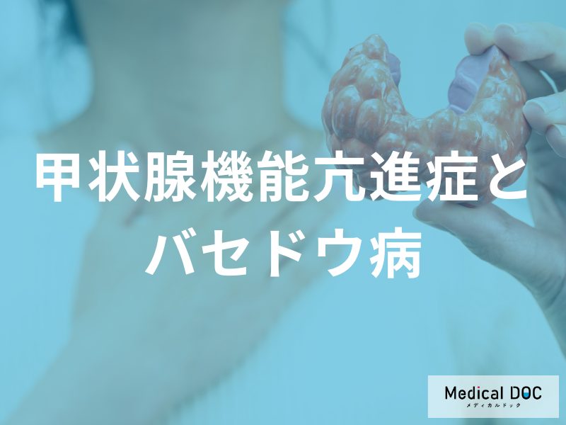 原因の80〜90％はバセドウ病？甲状腺ホルモンが過剰になる仕組みと3つの治療法