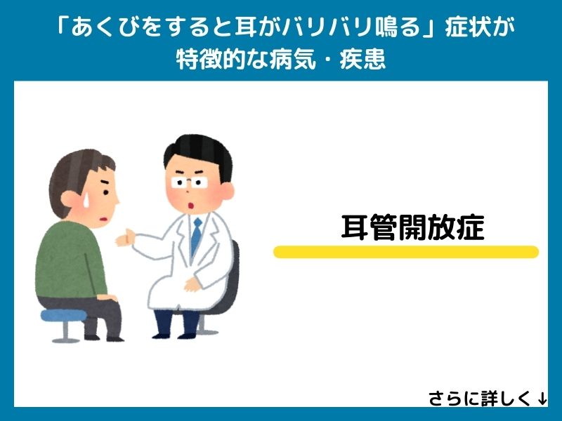 「あくびをすると耳がバリバリ鳴る」症状が特徴的な病気・疾患