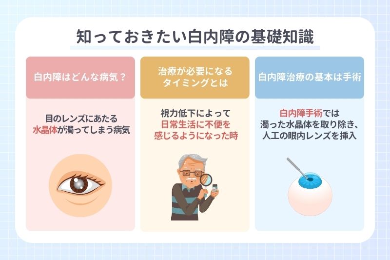 知っておきたい白内障の基礎知識