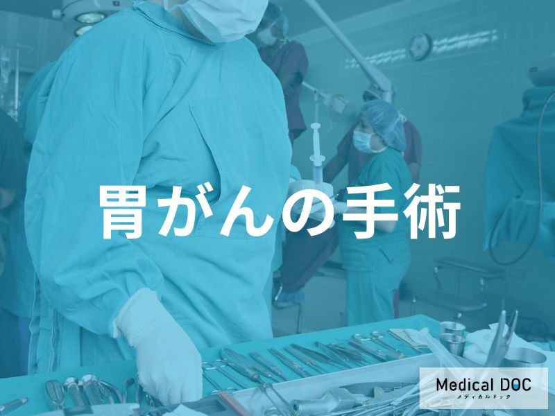 胃がんの手術療法と術式の選択