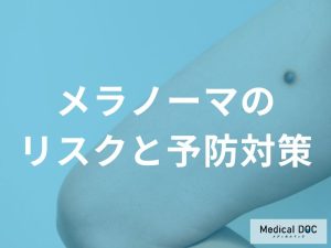 紫外線だけじゃない？メラノーマのリスク因子と予防対策を医師が解説