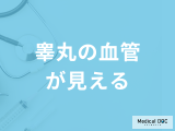 「睾丸の血管が見える」のは”病気”のサイン？受診の目安となる症状も医師が解説！