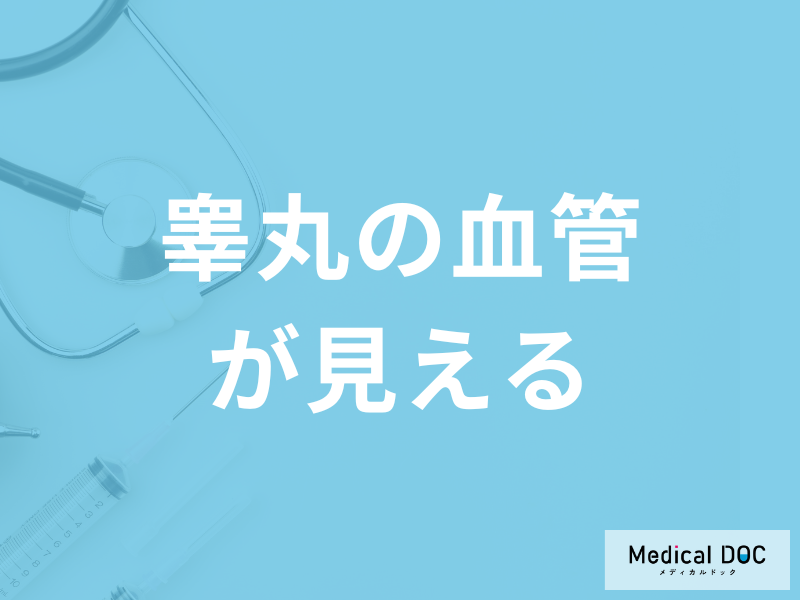 「睾丸の血管が見える」のは”病気”のサイン？受診の目安となる症状も医師が解説！