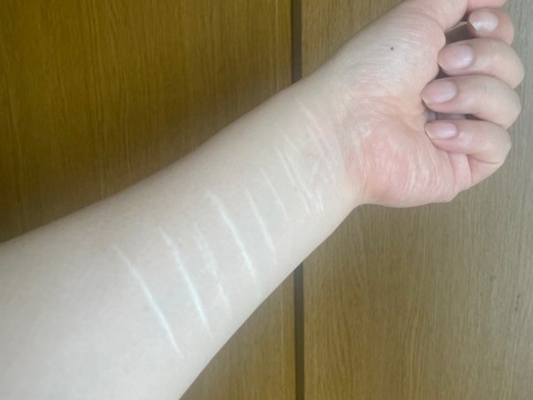 発症前とは180度違う生活