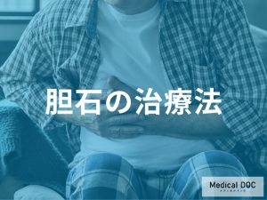胆石の治療法の選択肢