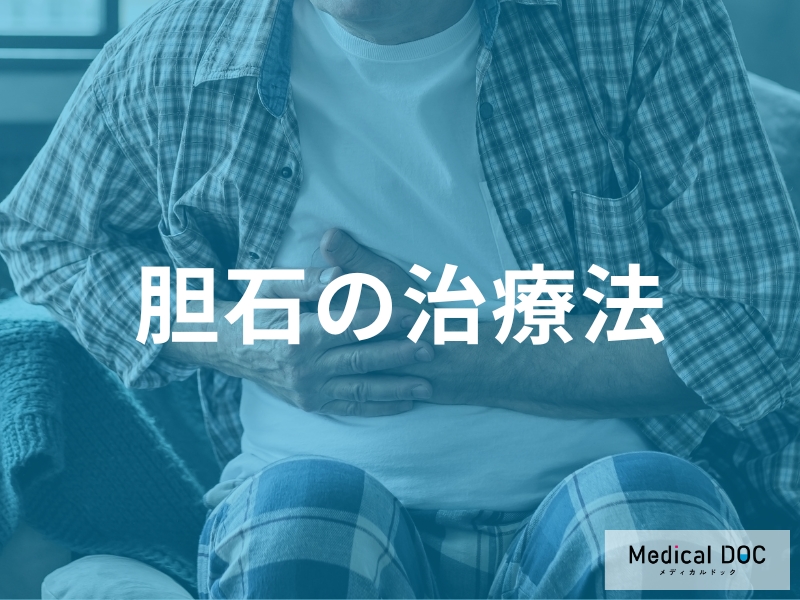 胆石の治療法の選択肢