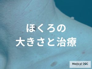 ほくろの大きさと治療の必要性