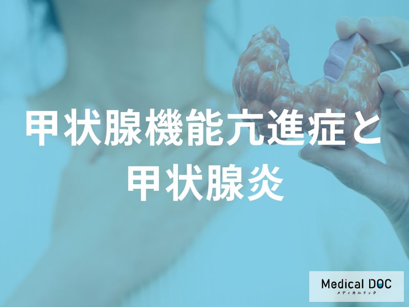 バセドウ病と何が違う？一時的にホルモンが漏れ出す「2つの甲状腺炎」の特徴と経過