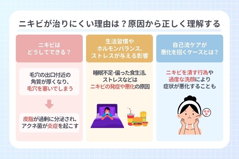 ニキビが治りにくい理由は？原因から正しく理解する