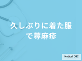 「久しぶりに着た服で蕁麻疹」になる原因はアレルギー？対処法も医師が解説！