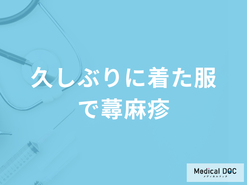 「久しぶりに着た服で蕁麻疹」になる原因はアレルギー？対処法も医師が解説！