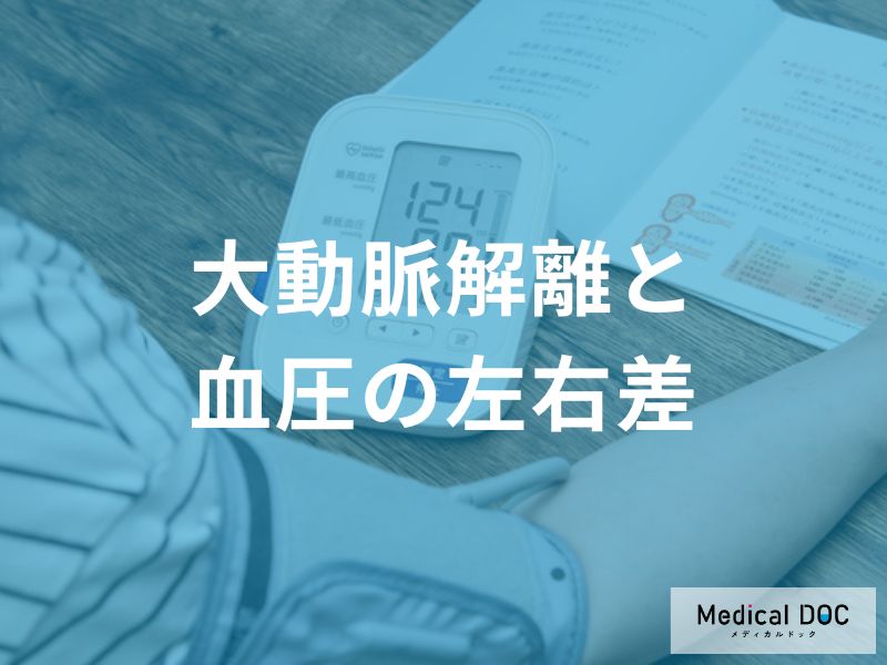 「血圧の左右差」がどれくらいあると「大動脈解離」を発症しやすくなる？医師が解説！