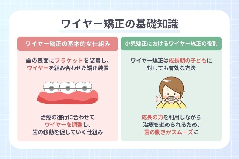 ワイヤー矯正の基礎知識