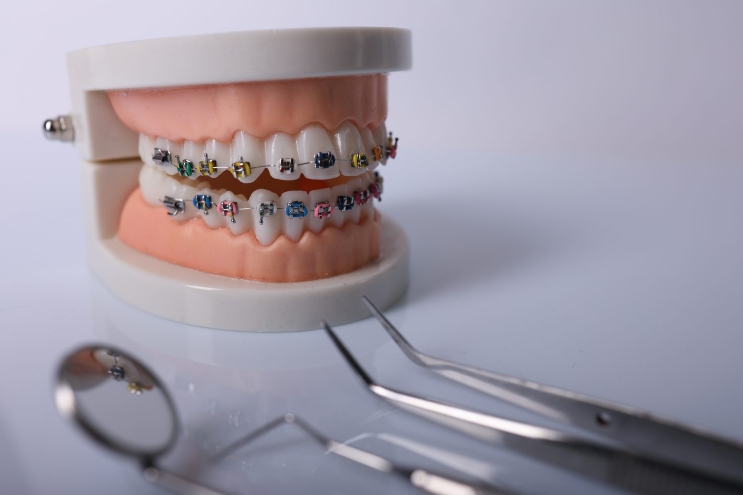 【重症度別】受け口の特徴と治療法