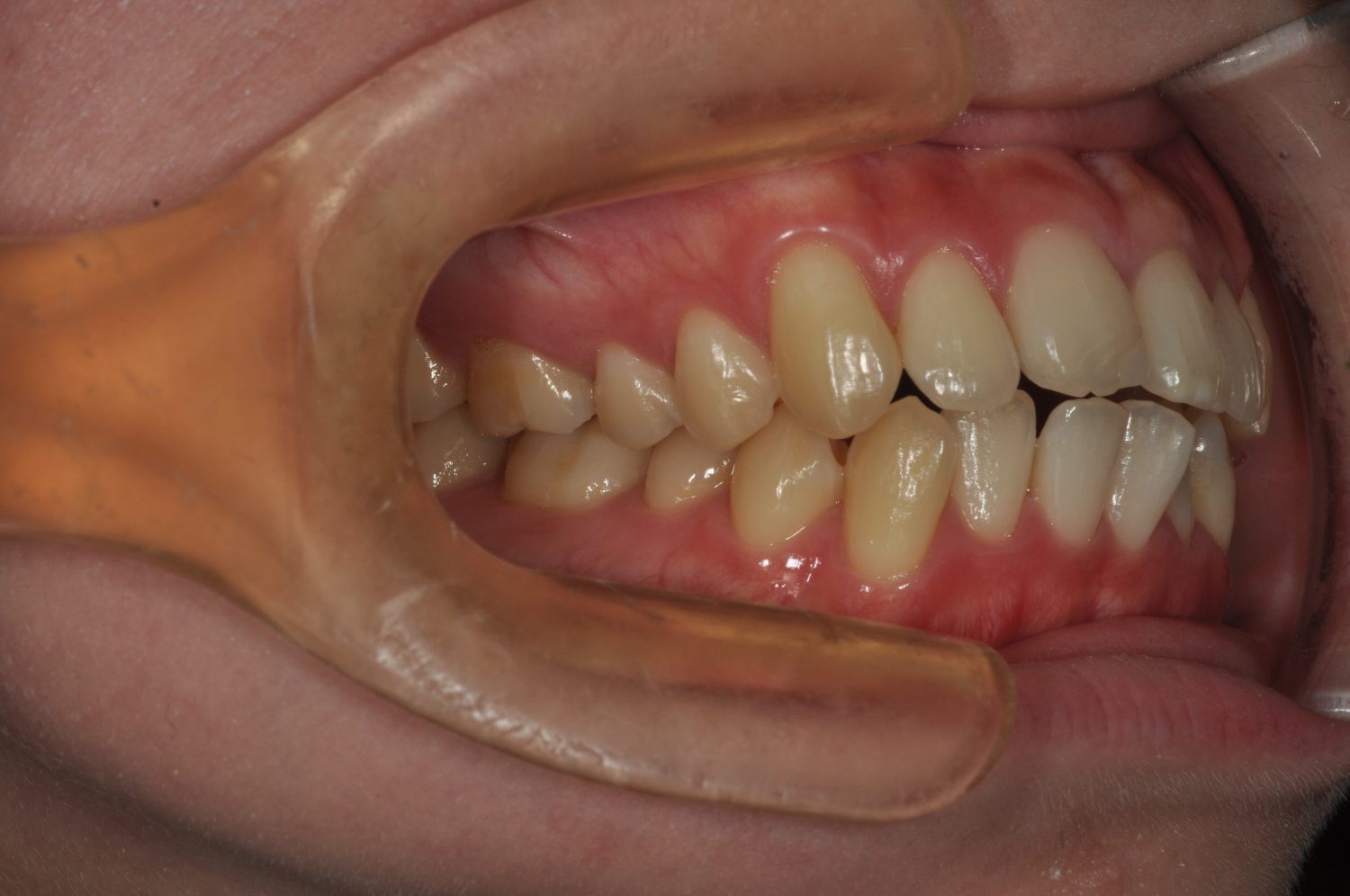 ふくしま矯正歯科クリニック