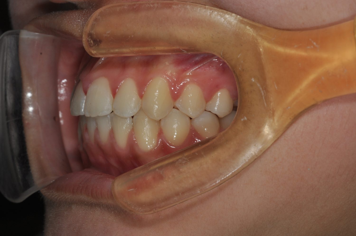 ふくしま矯正歯科クリニック