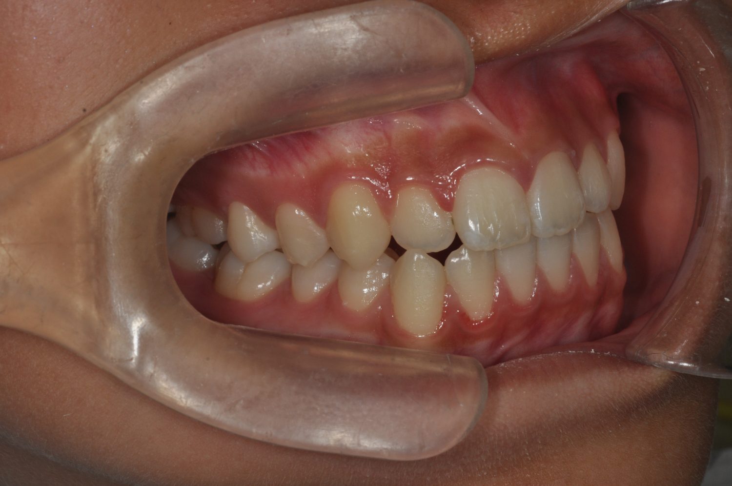 ふくしま矯正歯科クリニック