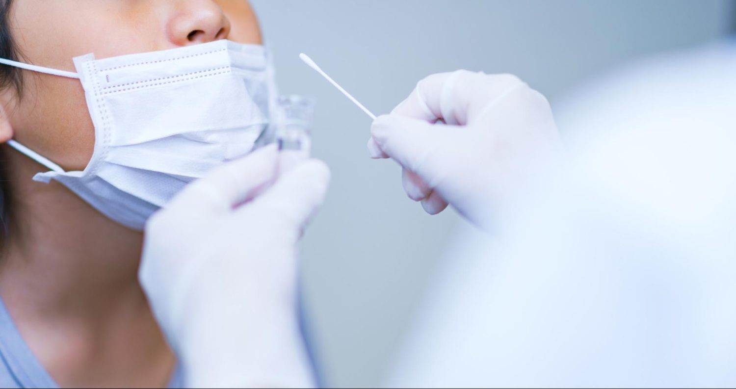 溶連菌感染症の検査と注意点