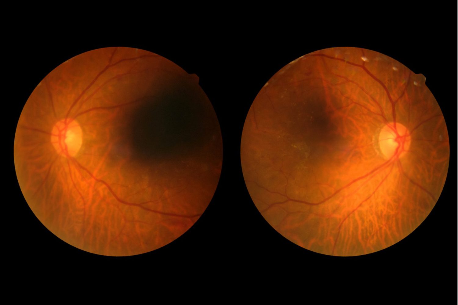 見た目に異常がなくてもすぐに受診が必要な理由