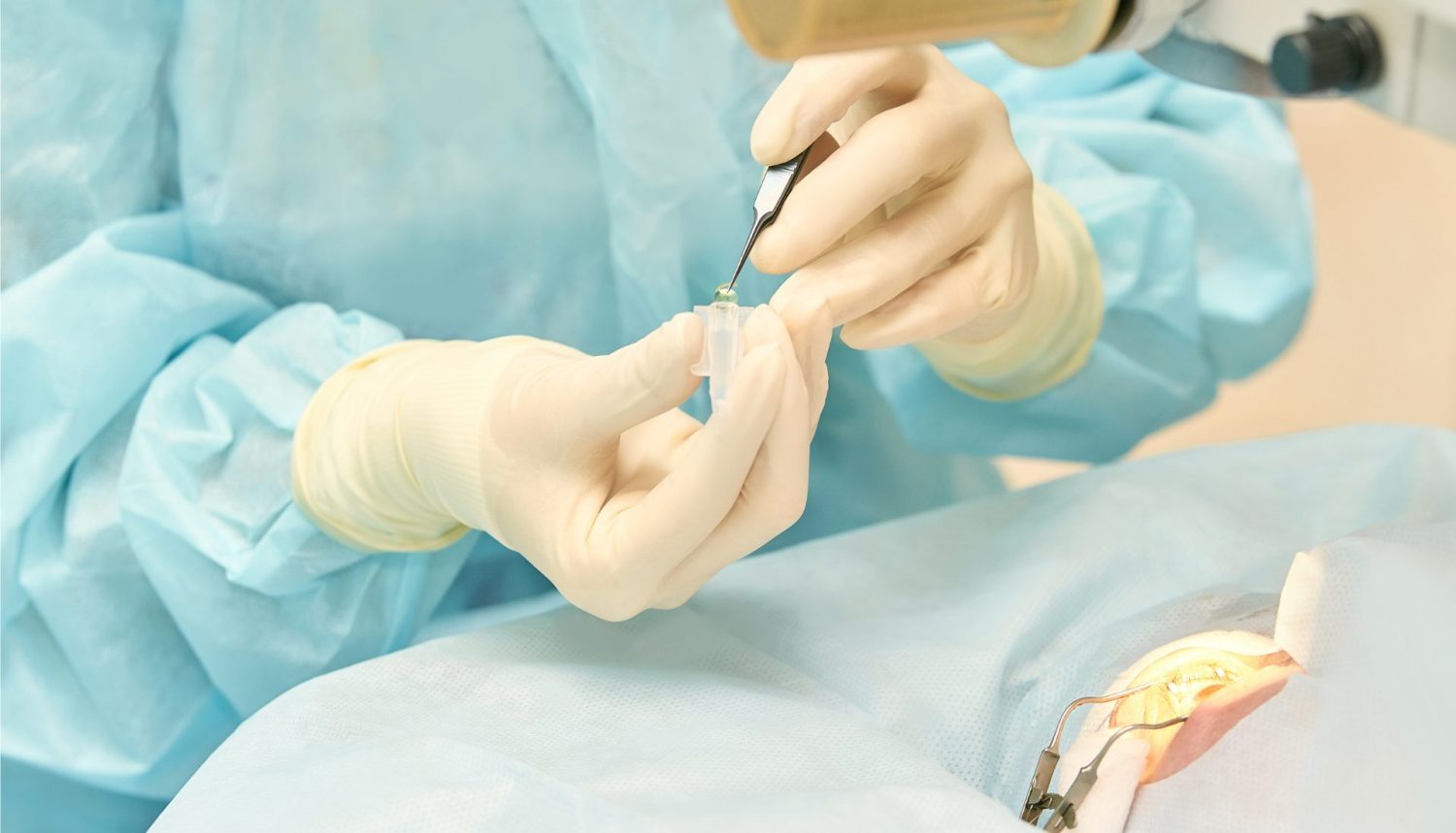 網膜剥離の治療方法