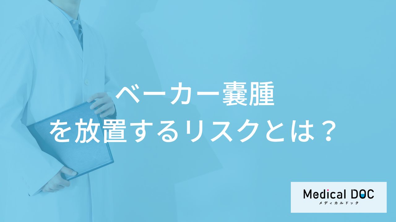 「ベーカー嚢腫」を”放置するリスク”とは?気をつけた方が良い姿勢も解説!