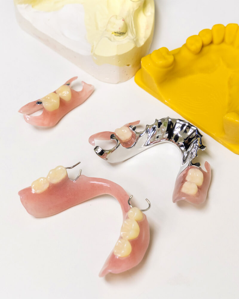 見た目の違和感が少なく自然なフィット感を追求したミラクルデンチャーとコンフィードデンチャー