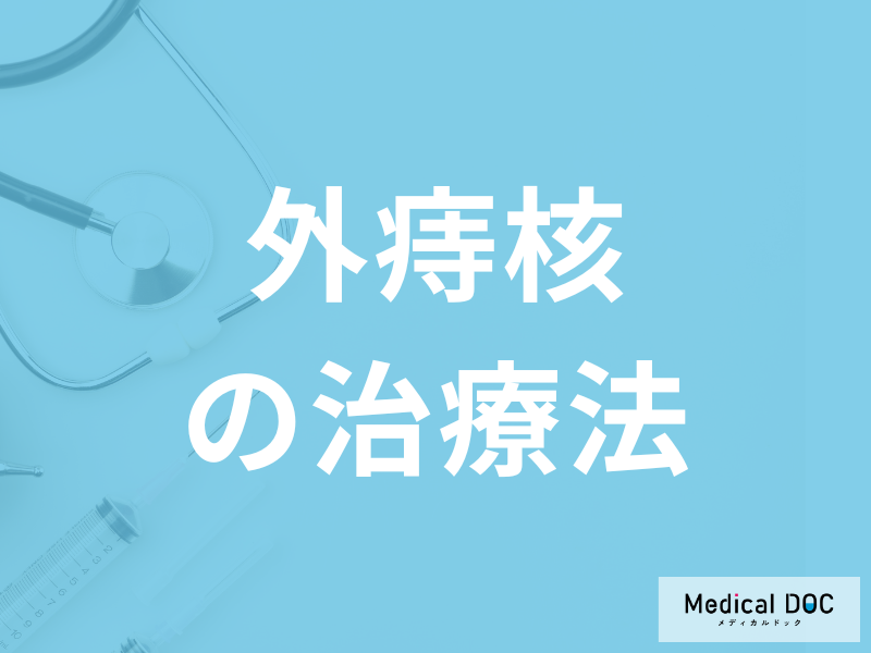 「外痔核の治療」に手術は必要かご存じですか?予防法も医師が解説!
