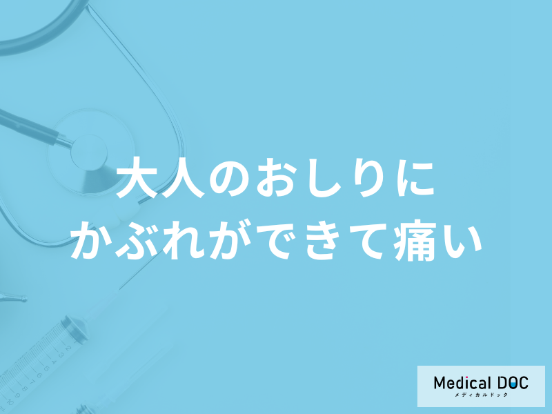 「大人のおしりにかぶれ」ができて『痛い』ときの対処法は？原因も医師が解説！