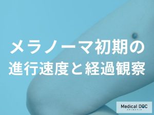 メラノーマの進行速度は？初期の変化に気づくためのポイントを医師が解説