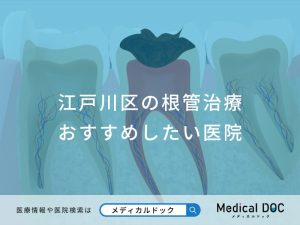 江戸川区の根管治療 おすすめしたい医院