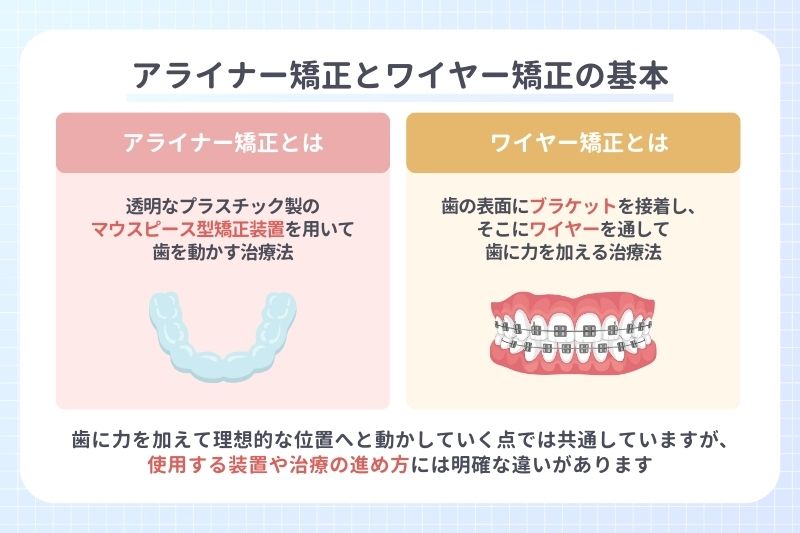 アライナー矯正とワイヤー矯正の基本