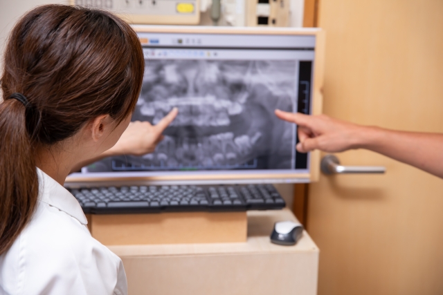 サイナスリフトと骨移植の治療について