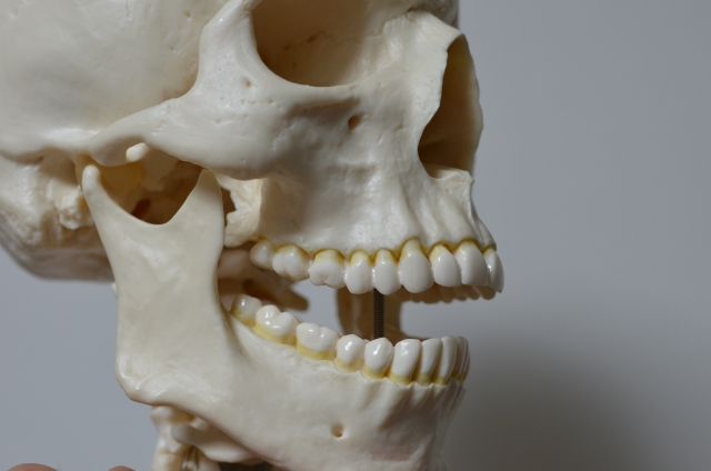 インプラント治療における骨移植が失敗する原因