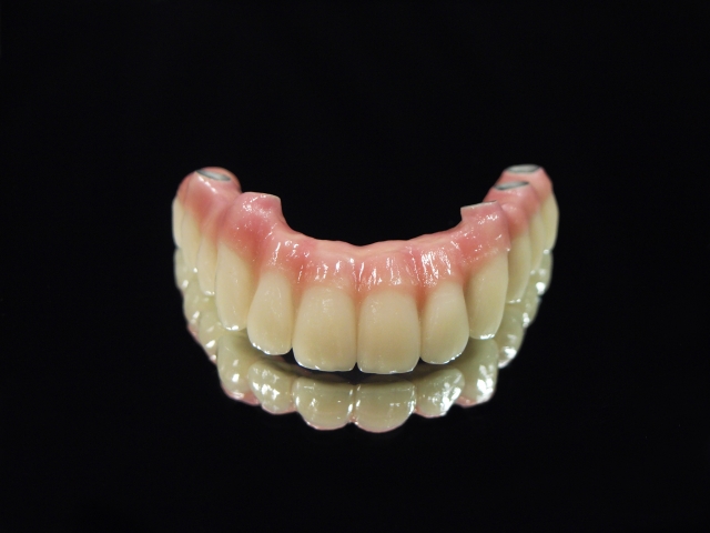 インプラントオーバーデンチャーの基礎知識