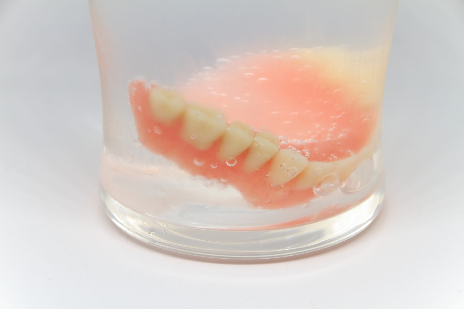 寿命は？ 壊れたら？ ノンクラスプデンチャーの維持管理