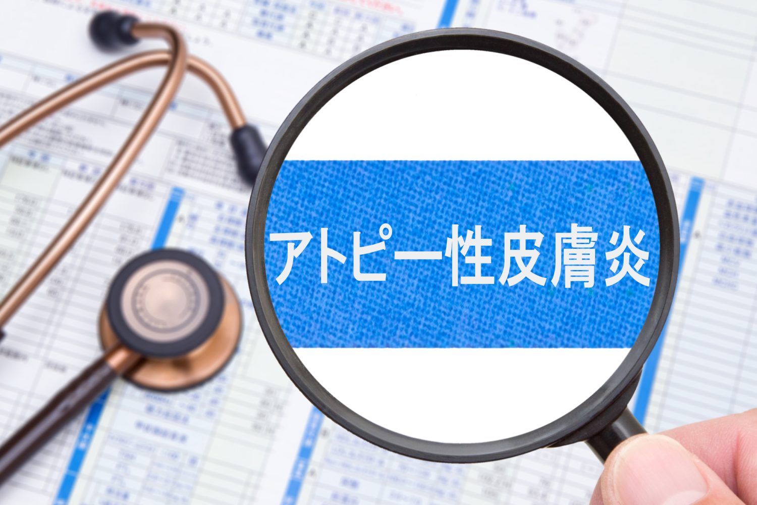 アトピー性皮膚炎とはどんな病気?