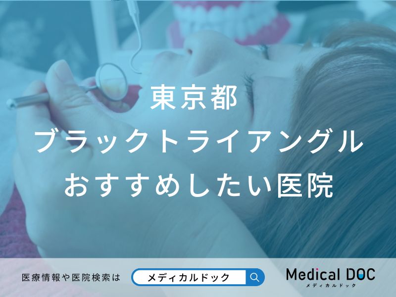 東京都 ブラックトライアングル