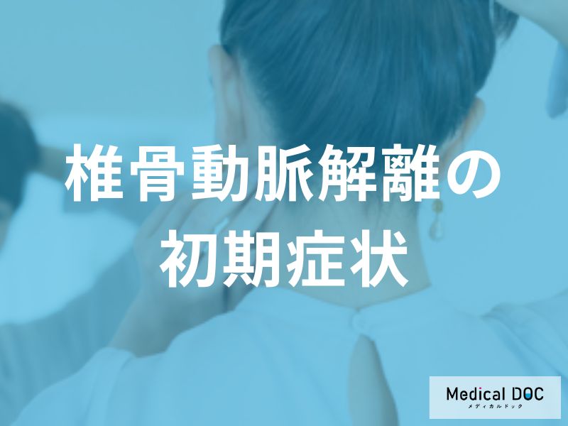 椎骨動脈解離の初期症状を見逃さないために