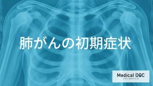 肺がんの初期症状と進行時の変化