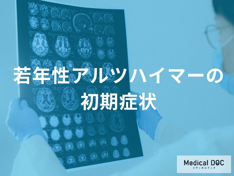 仕事のミスや道迷い… 40〜50代「若年性アルツハイマー」を疑うべき5つの変化