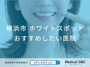 横浜市 ホワイトスポット