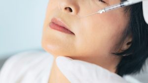 くせじわ、輪郭じわへのヒアルロン酸注入ってどのくらい効果が持続するの？【医師に聞く】
